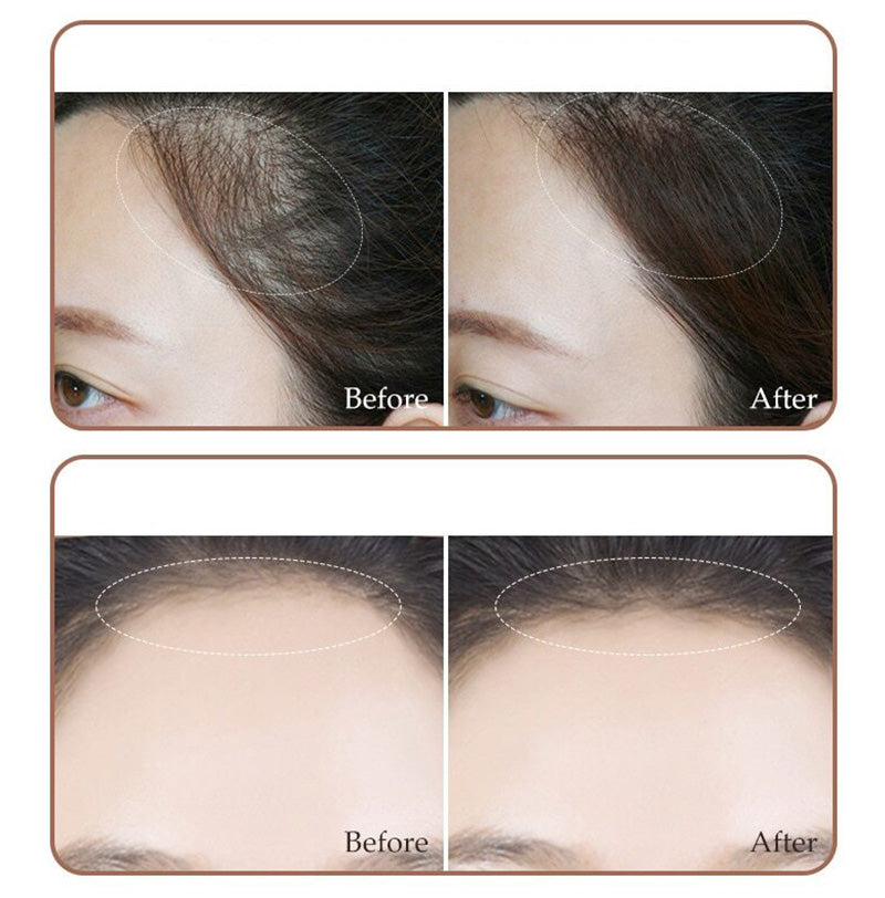 2 in 1 Hairline & Eyebrow Shaping Stamp